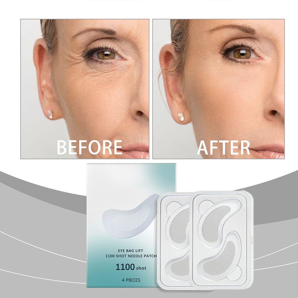 Parches para ojos con microagu - Microneedle Patch Eye reseña y precio