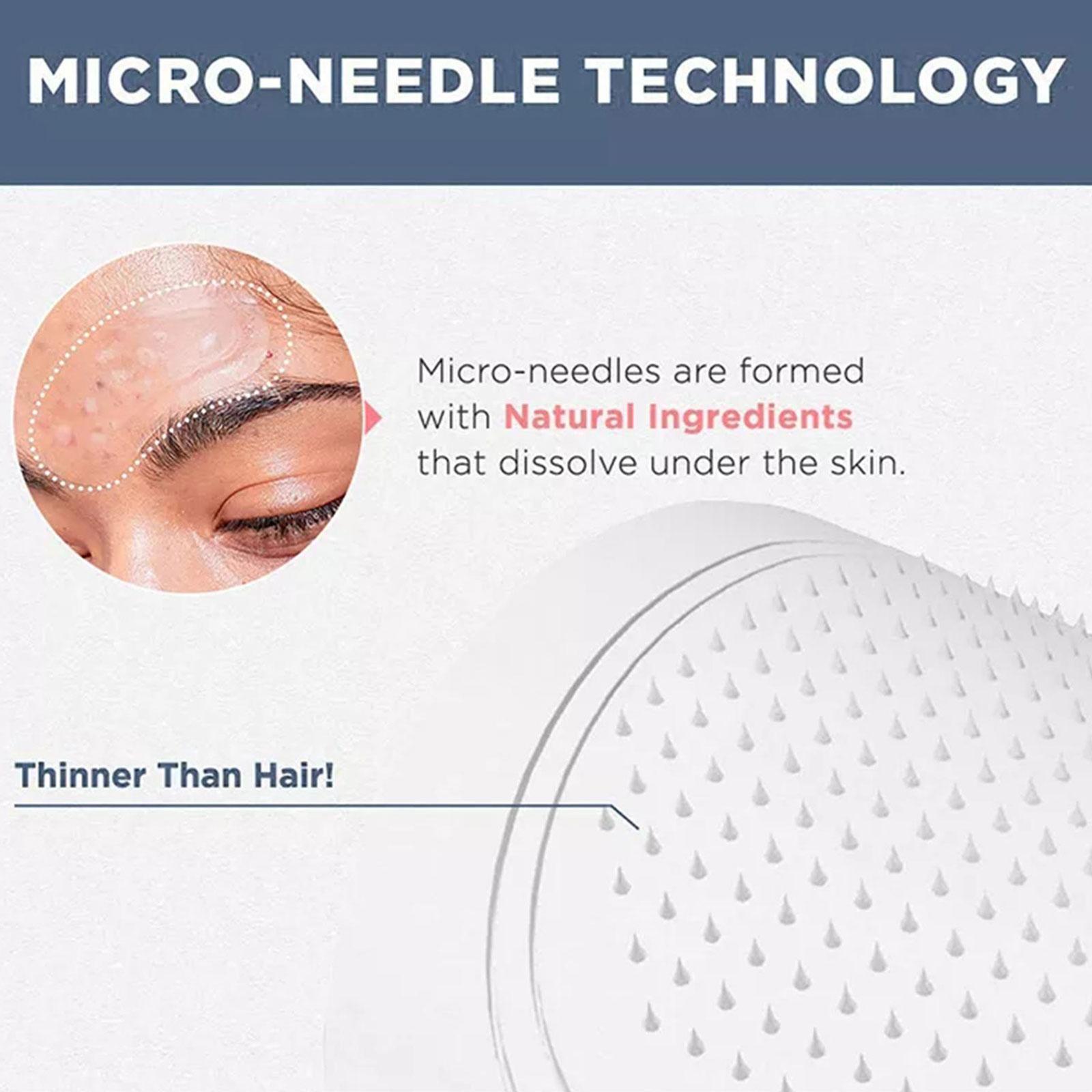 Mascarilla de Microagujas de 0 - Microneedle Patch Eye reseña y precio